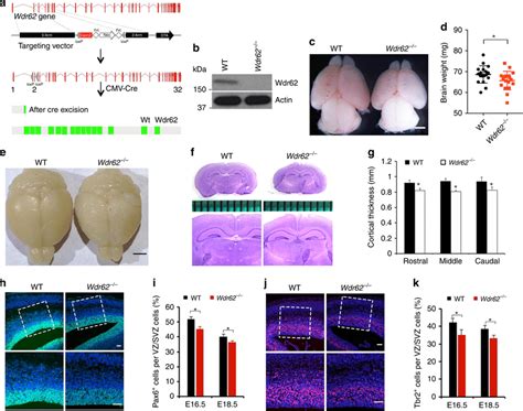 Wdr62 Deletion In Mice Results In Smaller Brain Size And Reduced Npcs