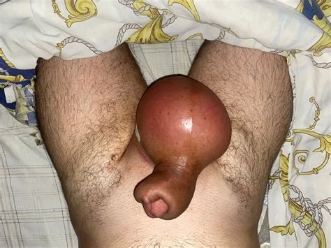 Balls Inflation Liters Nude Pics Xhamster