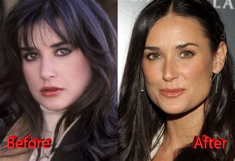 Demi Moore Plastic Surgery Gone Too Far