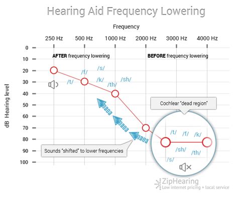 Frequency Lowering In Hearing Aids Ziphearing