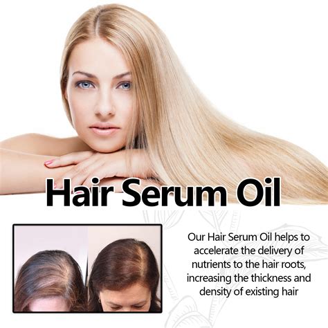 Hair Growth Essential Oil Anti Hair Loss Prevent Baldness Repair