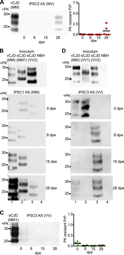 Differing Kinetics Of Vcjd And Scjd Prion Propagation In Human