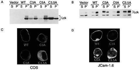 Subcellular localization of LCK mutants expressed in COS-18 and ...