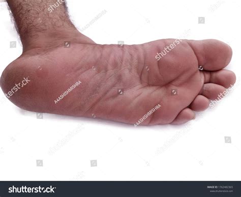 Bare Feet Naked Legs Sole Closeup Stock Photo Edit Now