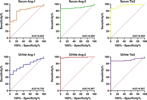 Ang 1 Ang 2 and Tie2 are diagnostic biomarkers for Henoch Schönlein