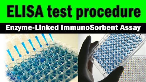 ELISA test procedure | Enzyme-Linked Immunosorbent Assay (step by step ... 