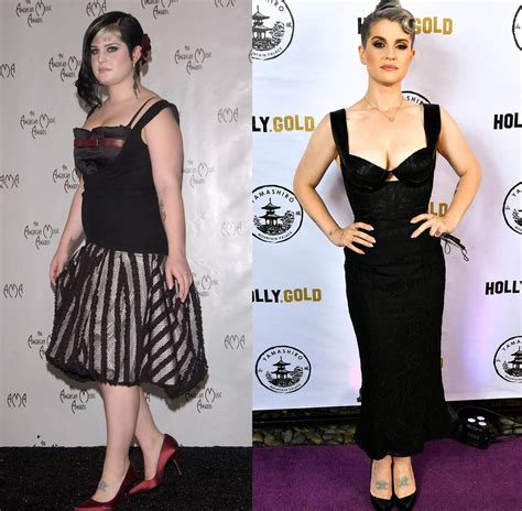 Kelly Osbourne: Weight Loss Story and Gastric Sleeve Surgery