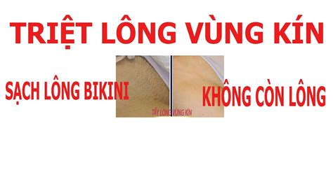 Triệt lông vùng kín uy tín tphcm bạn muốn triệt lông bikini hết sạch lông tơ mảnh spa ngoc