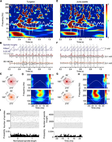 Figure 1 From Identified Cellular Correlates Of Neocortical Ripple And