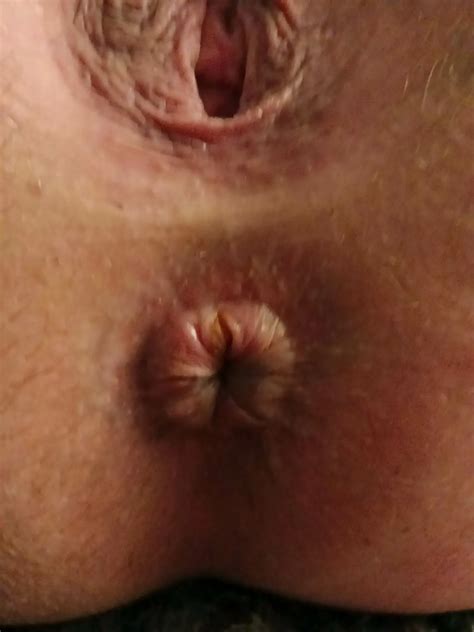 Rare Hairy Pussy Photos 16 Nude Pics XHamster