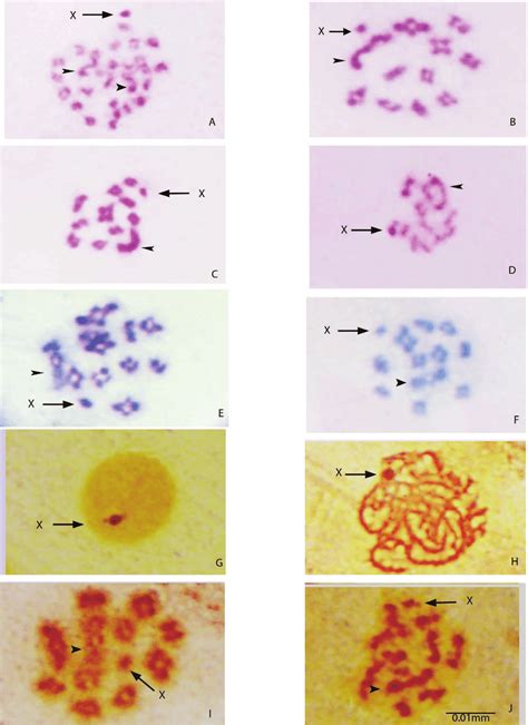 A Spermatogonial Metaphase B Diakinesis C Metaphase I D