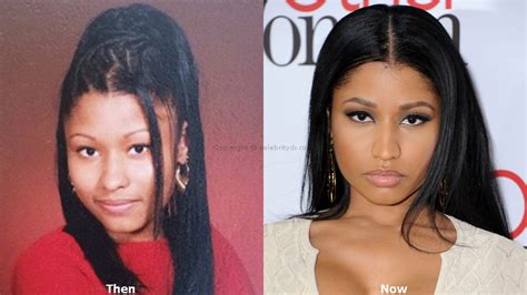 Nicki Minaj Before Plastic Surgery And After Surgery What Does Nicki Minaj Look Like