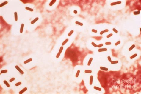 Clostridium Perfringens Gram Stain