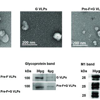 Characterization Of The VLPs VLPs Expressing The RSV Pre F G Or Both