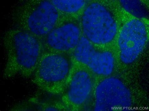 Parp1 Antibody 13371 1 Ap Proteintech