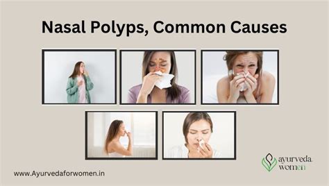 Nasal polyps Symptoms and causes