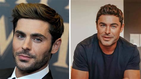 ¿zac Efron Se Realizó Cirugía Plástica En El Rostro