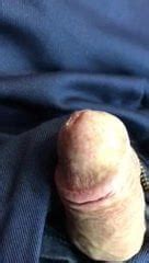 Mosquito On My Dick Cock Free Gay Cock Porn B XHamster XHamster