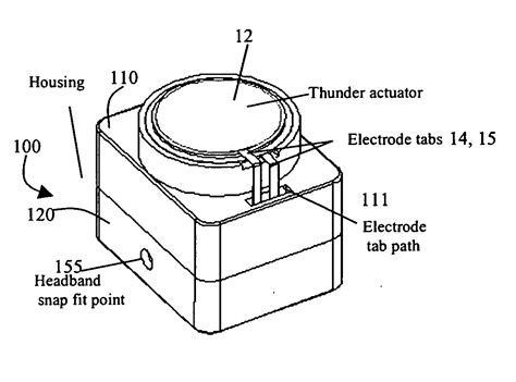 Bone Conduction Hearing Aid Patented Technology Retrieval Search