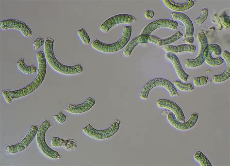 Wissenswertes zur Mikroalge Spirulina