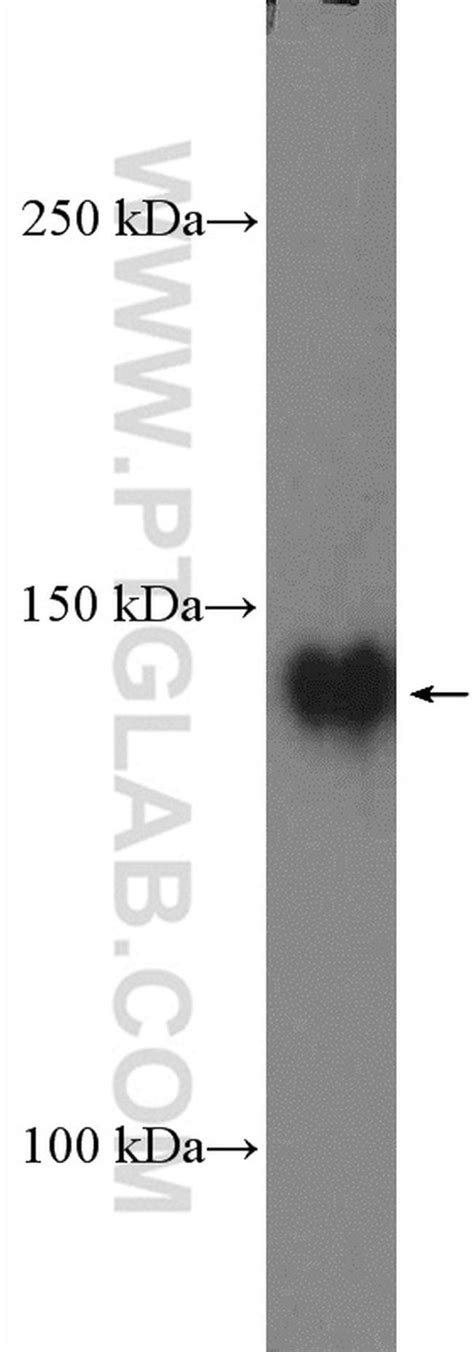 Ptk Rabbit Anti Human Mouse Rat Polyclonal Proteintech L