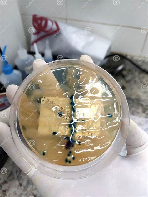 Pseudomonas Aeruginosa Urine Culture On Chromogenic Agar Stock Image