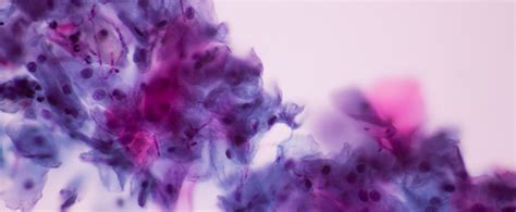 Yeast overgrowth / Candida. What is it? | Laravel