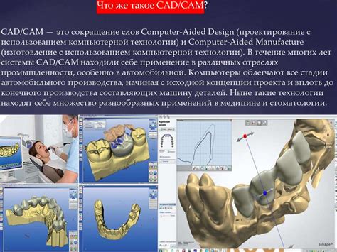 CAD/CAM — решение для стоматологии - online presentation