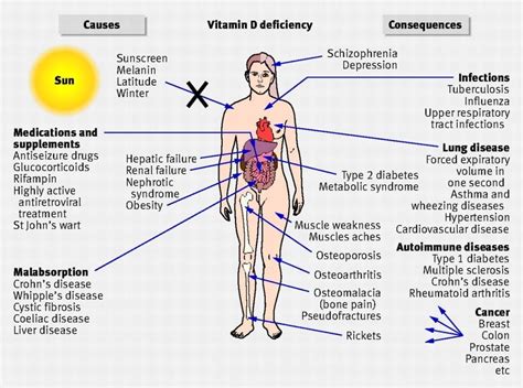 Vitamin D Injections in Phoenix, AZ | Suddenly Slimmer Med Spa