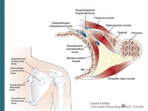 Scapula Pain | PPT