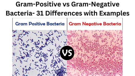 Gram Positive Vs Gram Negative Bacteria 31 Differences With Examples