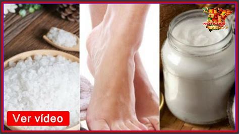 C Mo Ablandar Los Callos De Los Pies Con Remedios Naturales Youtube