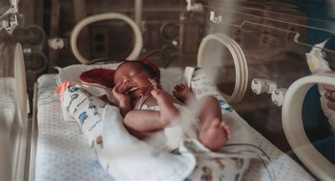 Preemie babies: Babies born at 32 weeks, 28 weeks, and earlier | BabyCenter