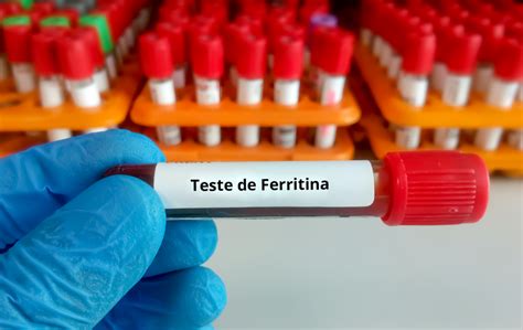 Ferritina Exame Para Que Serve - Exame de Ferro e Ferritina: qual a finalidade? • LabVital