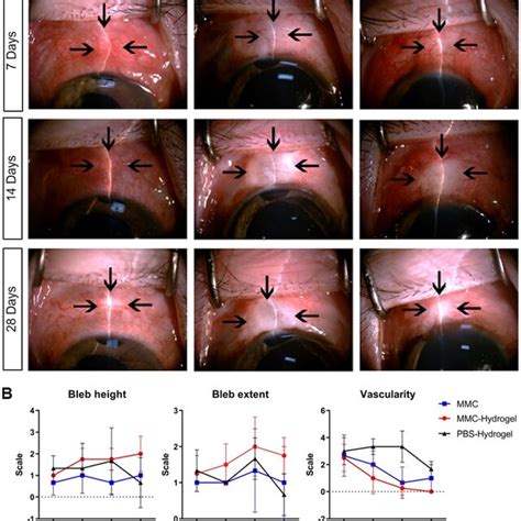 Mmc Loaded Hydrogel Maintained A Higher Volume Of Filtering Blebs Than