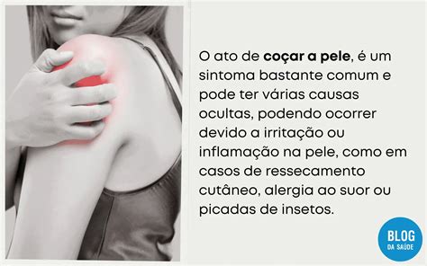 Coceira Pelo Corpo O Que Pode Ser Blog Da Sa De