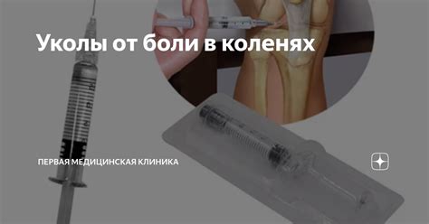 Уколы от боли в коленях | Первая Медицинская Клиника | Дзен
