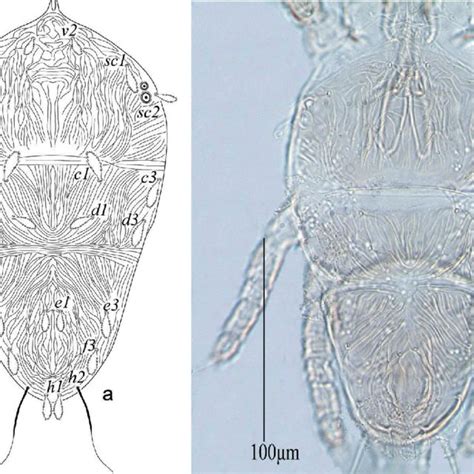 Pdf Flat Mites Acari Tenuipalpidae From Saudi Arabia Two New