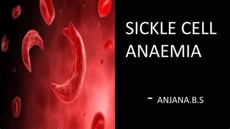 Sickle Cell Anaemia In Pregnancy For Mbbs Under Graduates Obg Ppt