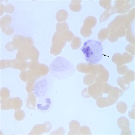 Acute myelomonocytic leukemia in a dog | eClinpath