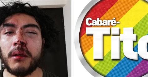 CDMX Denuncian violencia en bar gay Cabarétito acabó con fracturas