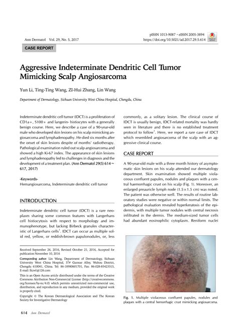 Pdf Aggressive Indeterminate Dendritic Cell Tumor Mimicking Scalp