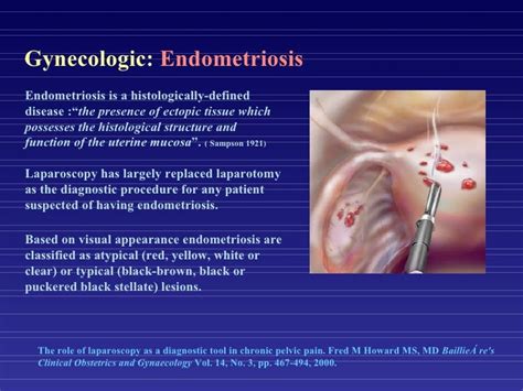 Diagnostic Laparoscopy for Pelvic Disorders