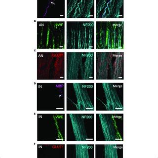 A panel of markers, applied with neurofilament-H (NF200), was used to ...