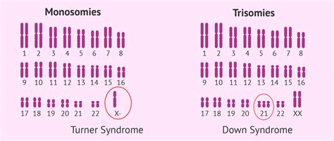 Types of aneuploidies compatible with life