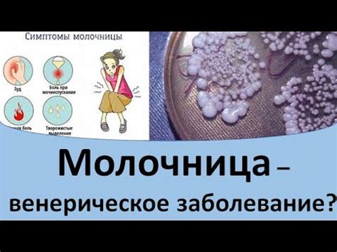 Молочница - венерическое заболевание? - YouTube