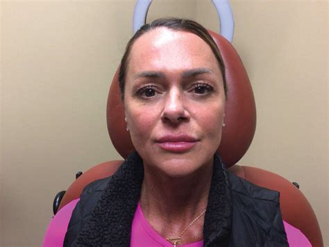 Facing "Ozempic Face" - PHOENIX magazine