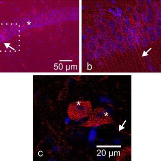 Slc F And Rab Proteins Analysis Using Transfected Glioblastoma Cells