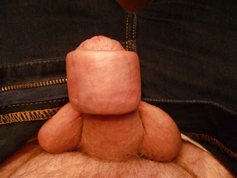 Uncut Penis Foreskin Stuffed Porn Pictures XXX Photos Sex Images 541926 PICTOA