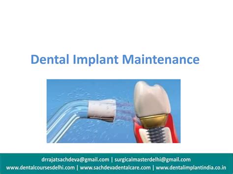 Dental Implant Maintenance , Dental Implant Care | PPTX